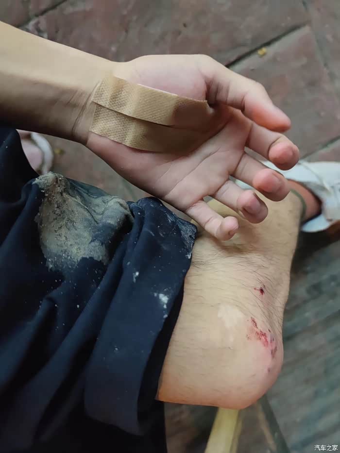 又是摔车的一天两个克膝头没得一处好皮肤了