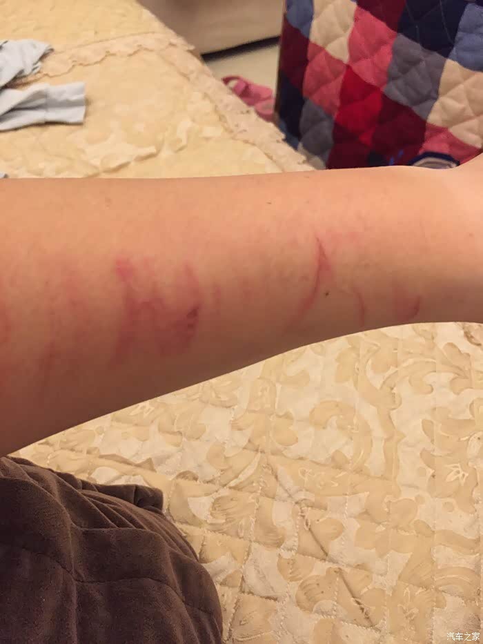 装好了,手被划伤了,所以,你懂的