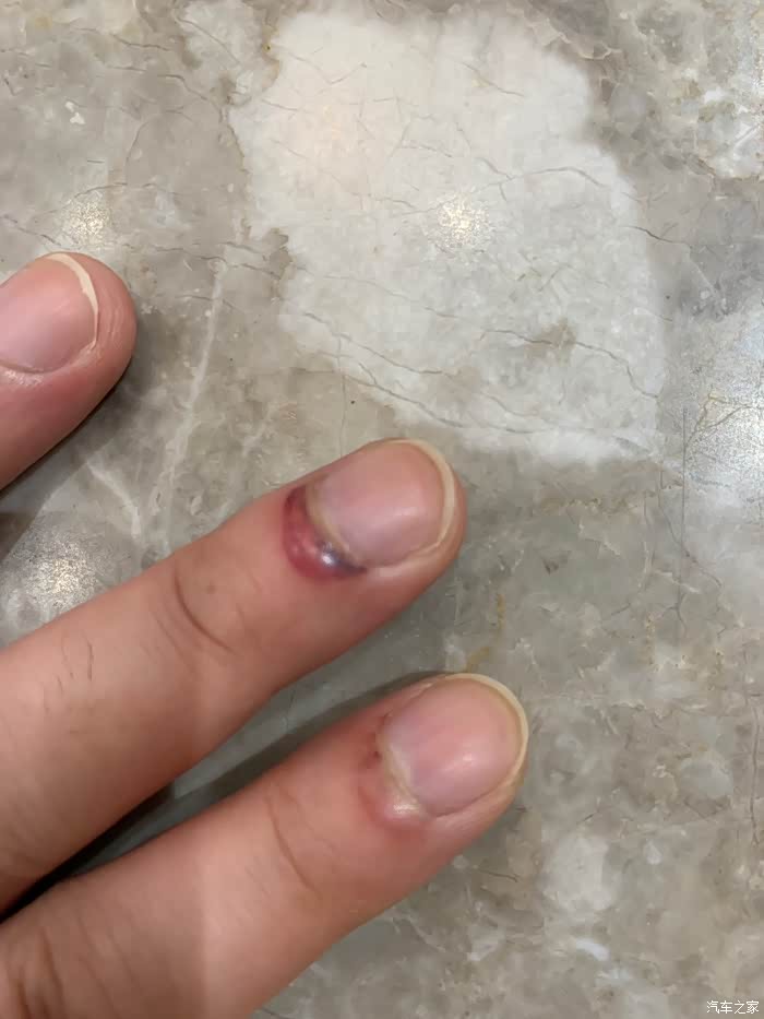 请注意一下电吸门……差点手骨头夹断了