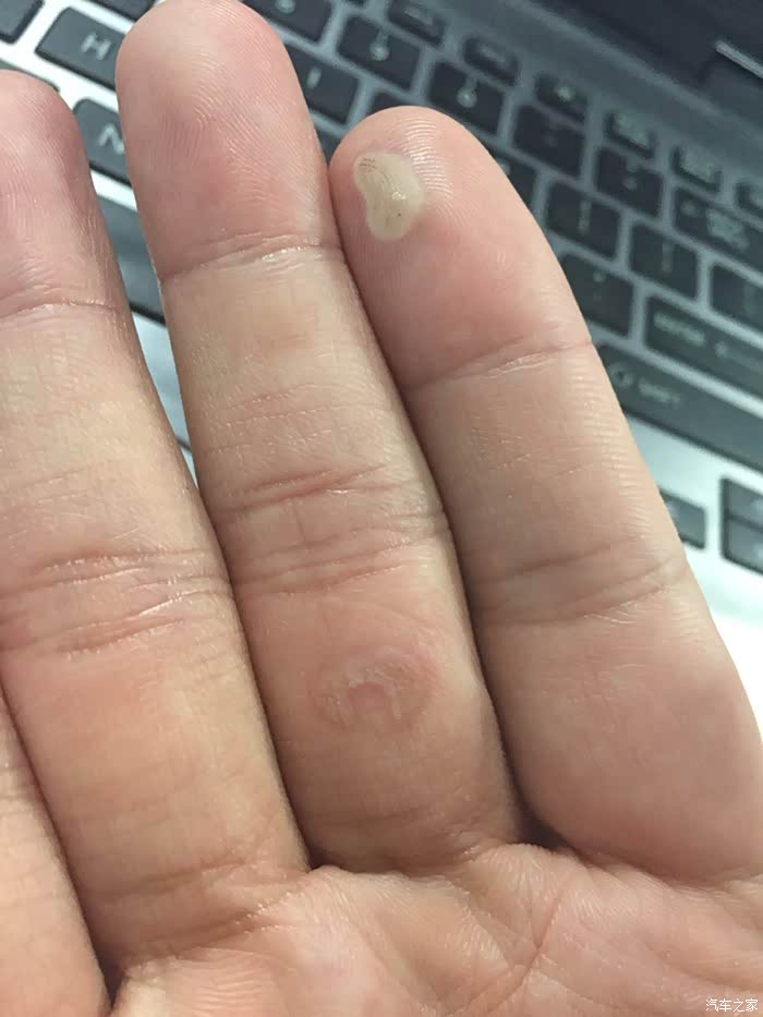 妈蛋我绝对不是第一个被点烟器烫焦皮的人