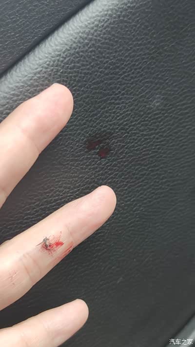 就刚刚,一地血,太惨了.