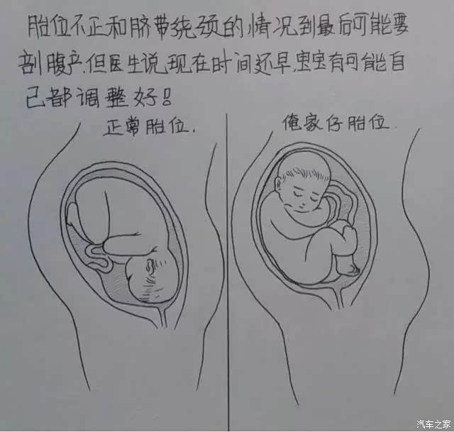 (下部)继续继续