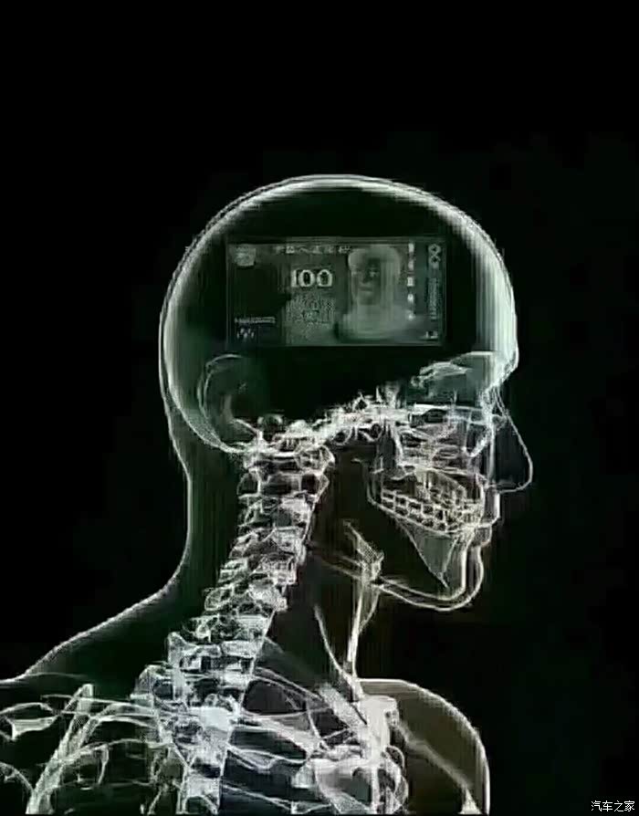 这些天,脑袋不舒服,做个ct后医生说你想的太多了!