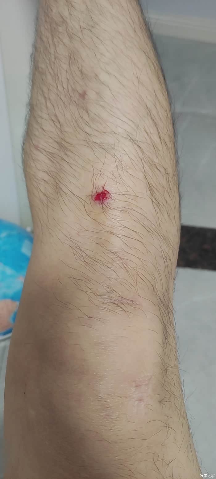 15年福睿斯老磕我膝盖有同感的吗