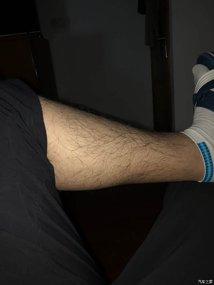 腿上毛不够多怎么办
