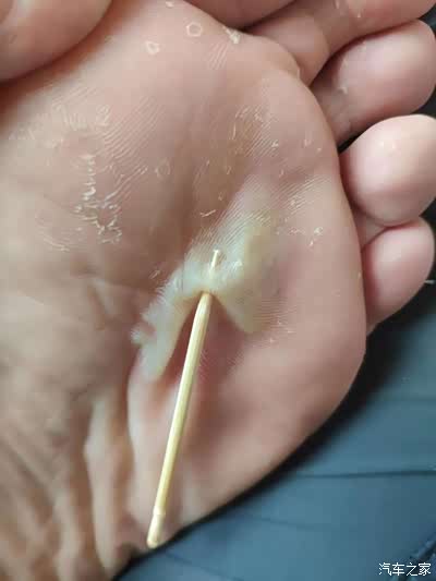 为自己打call  知道晚上的娱乐项目吗 即使比谁脚上的水泡射的远!