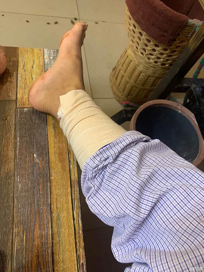 大伙来谈谈车险