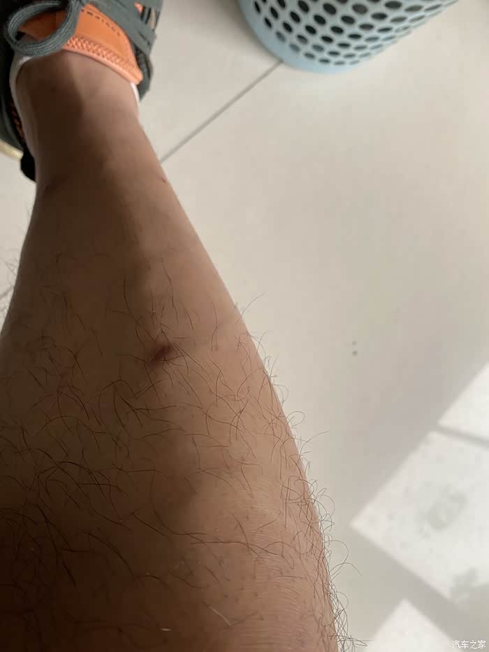 开门上车时候你的右膝被这个地方磕碰过吗?有的回复1