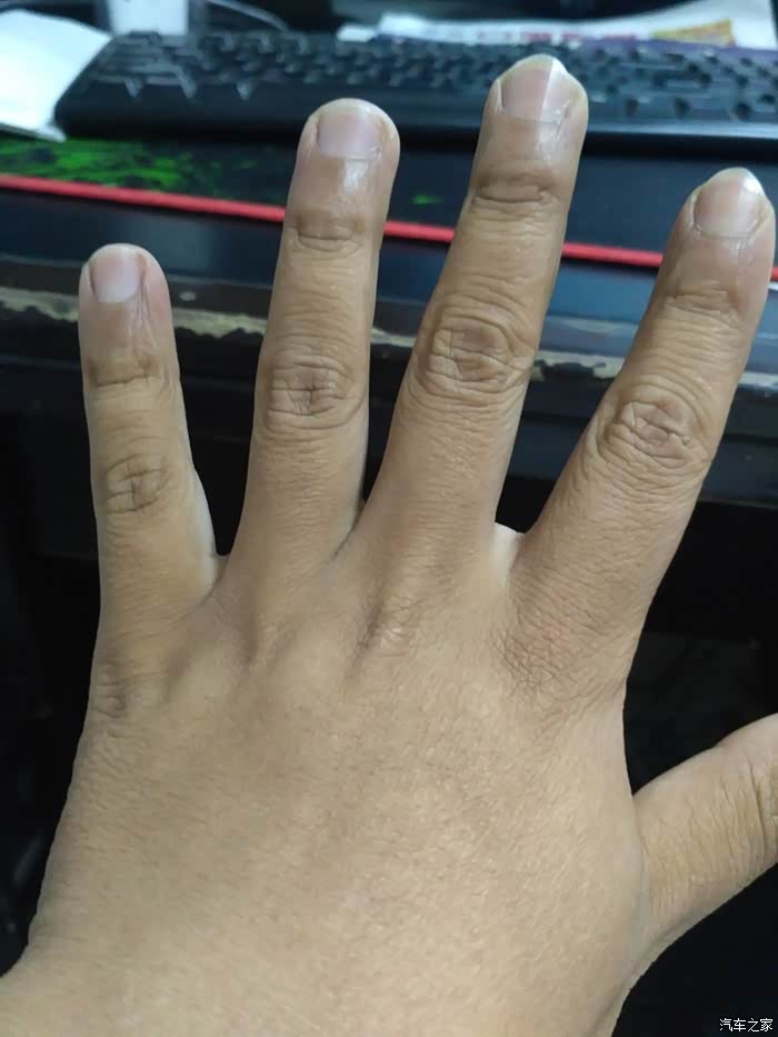 每天38度左右,都被晒黑了