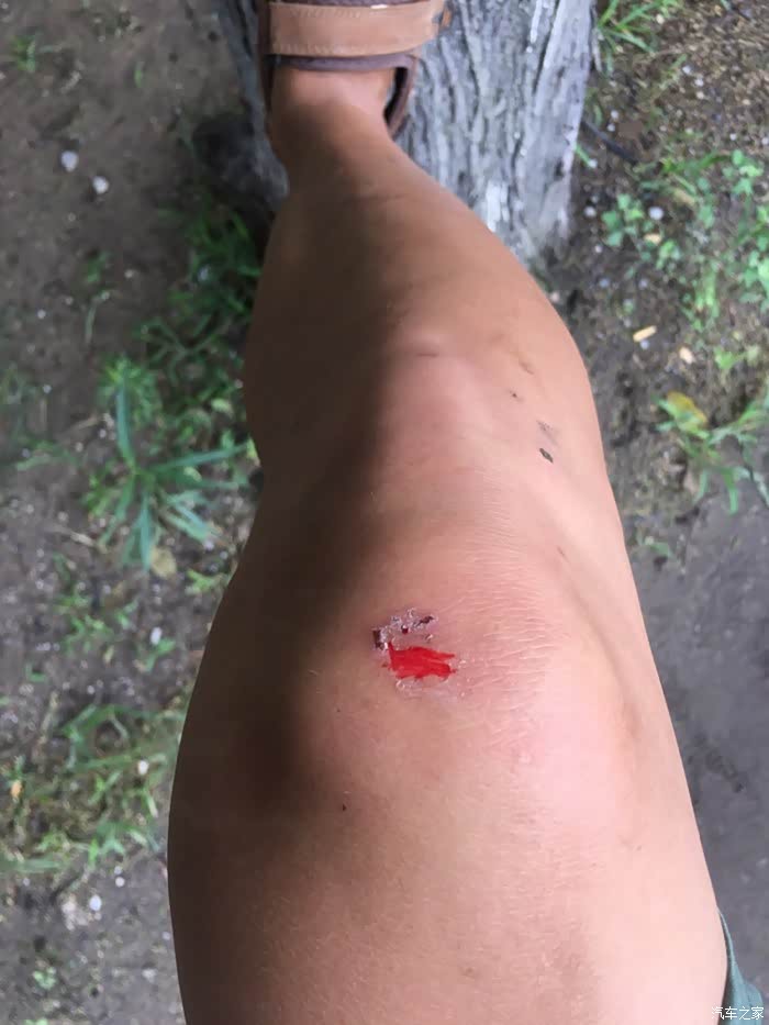 疤  次留带血  次