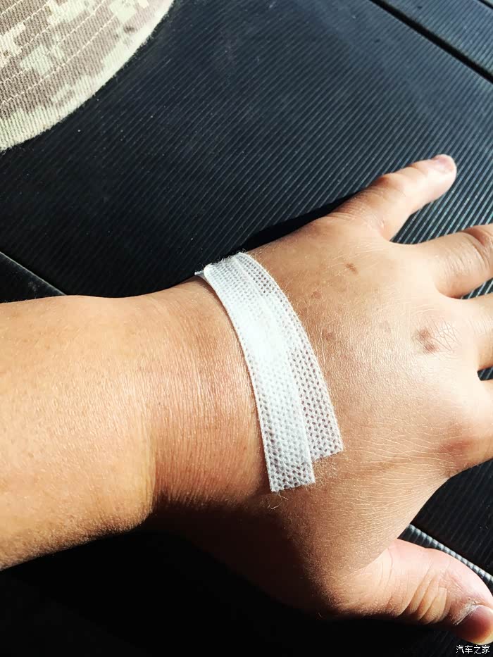 这凌晨输液时嫌太慢,自己动手调节快慢的结果,手变馒头手!