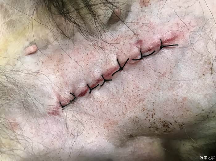 一翻身看到宝贝肚子上的伤口了,心疼